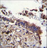 TTBK2 Antibody - TTBK2 Antibody immunohistochemistry of formalin-fixed and paraffin-embedded human lung tissue followed by peroxidase-conjugated secondary antibody and DAB staining.
