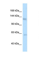 TTBK2 Antibody - TTBK2 antibody Western blot of Mouse Thymus lysate. Antibody concentration 1 ug/ml.  This image was taken for the unconjugated form of this product. Other forms have not been tested.