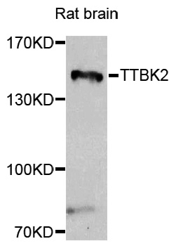 TTBK2 Antibody - Western blot analysis of extracts of rat brain.