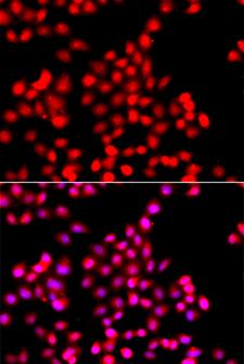 TTBK2 Antibody - Immunofluorescence analysis of A549 cells.