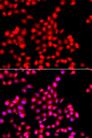 TTBK2 Antibody - Immunofluorescence analysis of A549 cells using TTBK2 Polyclonal Antibody.