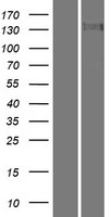 TTBK2 Protein - Western validation with an anti-DDK antibody * L: Control HEK293 lysate R: Over-expression lysate