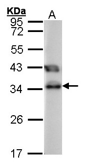 TTC1 Antibody - Sample (30 ug of whole cell lysate). A:293T. 12% SDS PAGE. TTC1 antibody diluted at 1:1000.