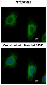 TTC1 Antibody - Immunofluorescence of paraformaldehyde-fixed HeLa using TTC1 antibody at 1:500 dilution.