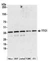 TTC1 Antibody - Detection of human and mouse TTC1 by western blot. Samples: Whole cell lysate (15 µg) from HeLa, HEK293T, Jurkat, mouse TCMK-1, and mouse NIH 3T3 cells prepared using NETN lysis buffer. Antibody: Affinity purified rabbit anti-TTC1 antibody used for WB at 0.04 µg/ml. Detection: Chemiluminescence with an exposure time of 3 minutes.