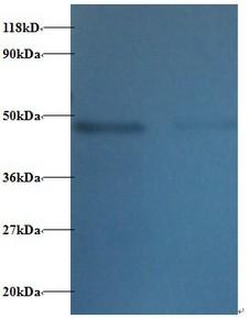 TTC1 Antibody - Western blot of Tetratricopeptide repeat protein 1 antibody at 2 ug/ml. Lane 1:293T whole cell lysate. Lane 2: EC109 whole cell lysate. Secondary: Goat polyclonal to Rabbit IgG at 1:15000 dilution. Predicted band size: 32 kDa. Observed band size: 45 kDa.  This image was taken for the unconjugated form of this product. Other forms have not been tested.