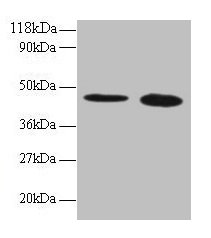 TTC1 Antibody - Western blot All lanes: Tetratricopeptide repeat protein 1 antibody at 2µg/ml Lane 1: 293T whole cell lysate Lane 2: EC109 whole cell lysate Secondary Goat polyclonal to rabbit IgG at 1/15000 dilution Predicted band size: 32 kDa Observed band size: 45 kDa