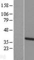 TTC1 Protein - Western validation with an anti-DDK antibody * L: Control HEK293 lysate R: Over-expression lysate