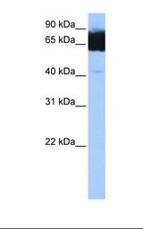 TTC12 Antibody - Fetal muscle lysate. Antibody concentration: 1.0 ug/ml. Gel concentration: 12%.  This image was taken for the unconjugated form of this product. Other forms have not been tested.