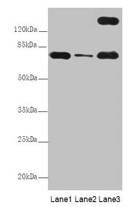 TTC12 Antibody - Western Blot All lanes: TTC12 antibody at 8µg/ml Lane 1: Mouse large intestine tissue Lane 2: Mouse small intestine tissue Lane 3: HepG2 whole cell lysate Secondary Goat polyclonal to rabbit IgG at 1/10000 dilution Predicted band size: 79, 82 kDa Observed band size: 79, 170 kDa