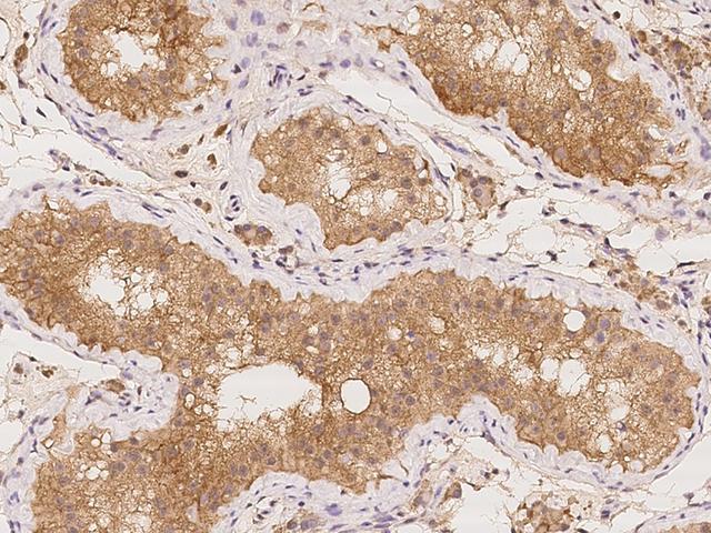 TTC12 Antibody - Immunochemical staining of human TTC12 in human testis with rabbit polyclonal antibody at 1:100 dilution, formalin-fixed paraffin embedded sections.