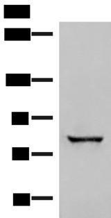 TTC12 Antibody - Western blot analysis of Human bladder transitional cell carcinoma grade 2-3 tissue lysate  using TTC12 Polyclonal Antibody at dilution of 1:300