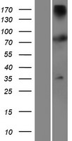 TTC12 Protein - Western validation with an anti-DDK antibody * L: Control HEK293 lysate R: Over-expression lysate