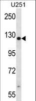 TTC13 Antibody - TTC13 Antibody western blot of U251 cell line lysates (35 ug/lane). The TTC13 antibody detected the TTC13 protein (arrow).