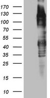 TTC14 Antibody - HEK293T cells were transfected with the pCMV6-ENTRY control. (Left lane) or pCMV6-ENTRY TTC14. (Right lane) cDNA for 48 hrs and lysed