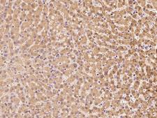 TTC14 Antibody - Immunochemical staining of human TTC14 in human liver with rabbit polyclonal antibody at 1:100 dilution, formalin-fixed paraffin embedded sections.