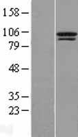 TTC14 Protein - Western validation with an anti-DDK antibody * L: Control HEK293 lysate R: Over-expression lysate
