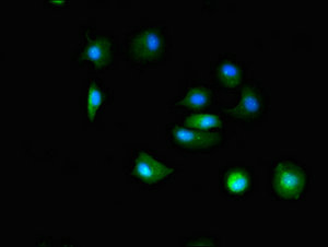 TTC19 Antibody - Immunofluorescent analysis of MCF-7 cells at a dilution of 1:100 and Alexa Fluor 488-congugated AffiniPure Goat Anti-Rabbit IgG(H+L)
