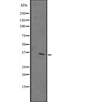 TTC19 Antibody - Western blot analysis of TTC19 expression in A431 whole cells lysate. The lane on the left is treated with the antigen-specific peptide.