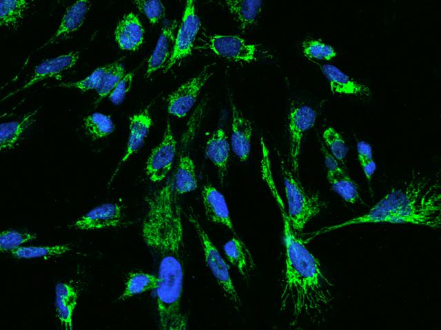 TTC19 Antibody - Immunofluorescence staining of TTC19 in U251MG cells. Cells were fixed with 4% PFA, permeabilzed with 0.1% Triton X-100 in PBS, blocked with 10% serum, and incubated with rabbit anti-Human TTC19 polyclonal antibody (dilution ratio 1:200) at 4°C overnight. Then cells were stained with the Alexa Fluor 488-conjugated Goat Anti-rabbit IgG secondary antibody (green) and counterstained with DAPI (blue). Positive staining was localized to Cytoplasm.