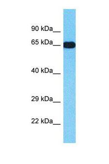 TTC22 Antibody - Western blot of Human Placenta. TTC22 antibody dilution 1.0 ug/ml.  This image was taken for the unconjugated form of this product. Other forms have not been tested.