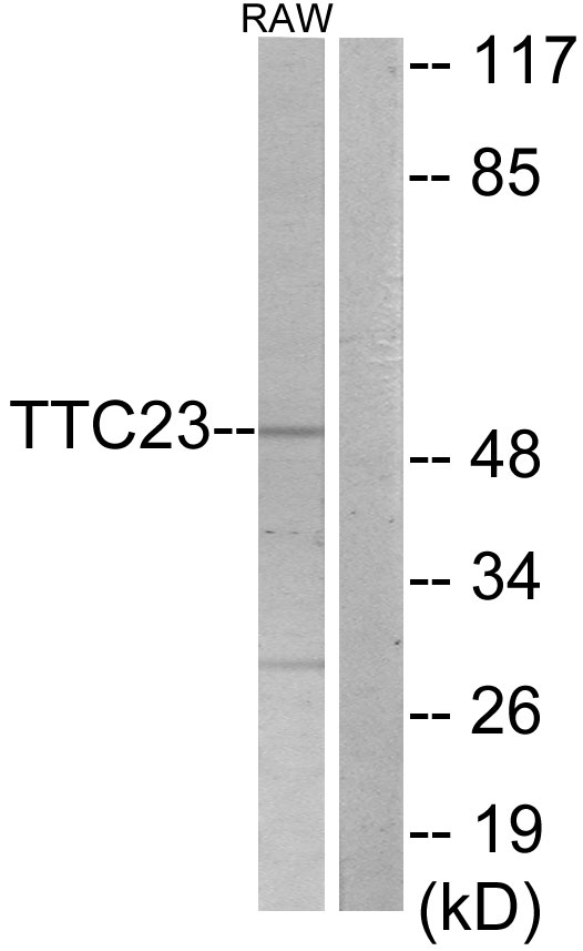 TTC23 Antibody - Western blot analysis of lysates from RAW264.7 cells, using TTC23 Antibody. The lane on the right is blocked with the synthesized peptide.