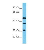 TTC23 Antibody - Western blot of Human 721_B. TTC23 antibody dilution 1.0 ug/ml.  This image was taken for the unconjugated form of this product. Other forms have not been tested.
