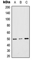 TTC23 Antibody - Western blot analysis of TTC23 expression in HEK293T (A); RAW264.7 (B); rat muscle (C) whole cell lysates.