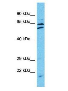TTC24 Antibody - TTC24 antibody Western Blot of HepG2. Antibody dilution: 1 ug/ml.  This image was taken for the unconjugated form of this product. Other forms have not been tested.