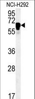 TTC26 Antibody - TTC26 Antibody western blot of NCI-H292 cell line lysates (35 ug/lane). The TTC26 antibody detected the TTC26 protein (arrow).