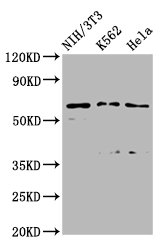 TTC26 Antibody - Western Blot Positive WB detected in: NIH/3T3 whole cell lysate, K562 whole cell lysate, Hela whole cell lysate All Lanes: TTC26 antibody at 2.45µg/ml Secondary Goat polyclonal to rabbit IgG at 1/50000 dilution Predicted band size: 65, 57, 61 KDa Observed band size: 65 KDa