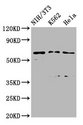 TTC26 Antibody - Western Blot Positive WB detected in: NIH/3T3 whole cell lysate, K562 whole cell lysate, Hela whole cell lysate All Lanes: TTC26 antibody at 2.45µg/ml Secondary Goat polyclonal to rabbit IgG at 1/50000 dilution Predicted band size: 65, 57, 61 KDa Observed band size: 65 KDa