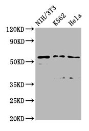 TTC26 Antibody - Western Blot Positive WB detected in: NIH/3T3 whole cell lysate, K562 whole cell lysate, Hela whole cell lysate All lanes: TTC26 antibody at 2.45µg/ml Secondary Goat polyclonal to rabbit IgG at 1/50000 dilution Predicted band size: 65, 57, 61 kDa Observed band size: 57 kDa
