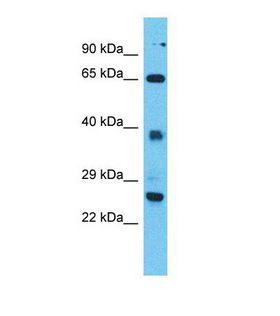 TTC26 Antibody - Western blot of Human Jurkat. TTC26 antibody dilution 1.0 ug/ml.  This image was taken for the unconjugated form of this product. Other forms have not been tested.