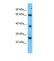 TTC26 Antibody - Western blot of Human Jurkat. TTC26 antibody dilution 1.0 ug/ml.  This image was taken for the unconjugated form of this product. Other forms have not been tested.