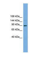 TTC27 Antibody - TTC27 antibody Western blot of Fetal Muscle lysate. This image was taken for the unconjugated form of this product. Other forms have not been tested.
