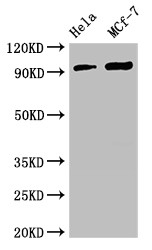 TTC27 Antibody - Positive WB detected in:Hela whole cell lysate,MCF-7 whole cell lysate;All lanes:TTC27 antibody at 2.7?g/ml;Secondary;Goat polyclonal to rabbit IgG at 1/50000 dilution;Predicted band size: 97 KDa;Observed band size: 97 KDa;