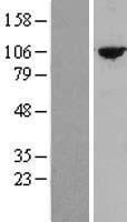 TTC27 Protein - Western validation with an anti-DDK antibody * L: Control HEK293 lysate R: Over-expression lysate