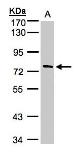 TTC30A Antibody - Sample (30 ug whole cell lysate). A: A431. 7.5% SDS PAGE. TTC30A antibody diluted at 1:1000