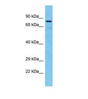 TTC30A Antibody - Western blot of Human Fetal Kidney. TTC30A antibody dilution 1.0 ug/ml.  This image was taken for the unconjugated form of this product. Other forms have not been tested.