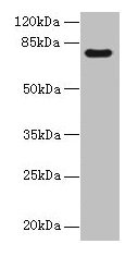 TTC30A Antibody - Western blot All lanes: TTC30A antibody at 0.1µg/ml + Mouse gonadal tissue Secondary Goat polyclonal to rabbit IgG at 1/10000 dilution Predicted band size: 76 kDa Observed band size: 76 kDa