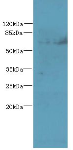 TTC30B Antibody - Western blot. All lanes: TTC30B antibody at 5 ug/ml. Lane 1: MDA-MB-231 whole cell lysate. Lane 2: U251 whole cell lysate. Secondary Goat polyclonal to Rabbit IgG at 1:10000 dilution. Predicted band size: 76 kDa. Observed band size: 76 kDa.