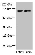 TTC30B Antibody - Western blot All lanes: TTC30B antibody at 5µg/ml Lane 1: MDA-MB-231 whole cell lysate Lane 2: U251 whole cell lysate Secondary Goat polyclonal to rabbit IgG at 1/10000 dilution Predicted band size: 76 kDa Observed band size: 76 kDa