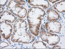 TTC32 Antibody - Immunohistochemical staining of paraffin-embedded Human Kidney tissue using anti-TTC32 mouse monoclonal antibody. (Dilution 1:50).