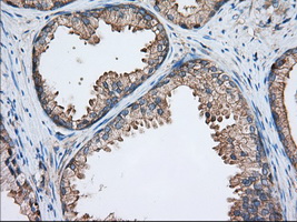 TTC32 Antibody - Immunohistochemical staining of paraffin-embedded Human prostate tissue using anti-TTC32 mouse monoclonal antibody. (Dilution 1:50).