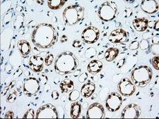 TTC32 Antibody - Immunohistochemical staining of paraffin-embedded Human Kidney tissue using anti-TTC32 mouse monoclonal antibody. (Dilution 1:50).