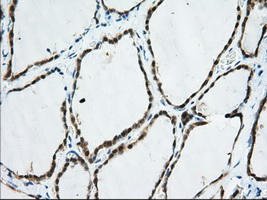 TTC32 Antibody - Immunohistochemical staining of paraffin-embedded Human thyroid tissue using anti-TTC32 mouse monoclonal antibody. (Dilution 1:50).