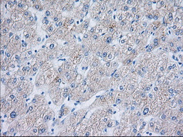 TTC32 Antibody - Immunohistochemical staining of paraffin-embedded Human liver tissue using anti-TTC32 mouse monoclonal antibody. (Dilution 1:50).