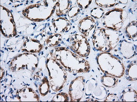 TTC32 Antibody - IHC of paraffin-embedded Human Kidney tissue using anti-TTC32 mouse monoclonal antibody. (Dilution 1:50).