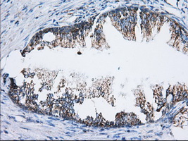 TTC32 Antibody - IHC of paraffin-embedded Human prostate tissue using anti-TTC32 mouse monoclonal antibody. (Dilution 1:50).